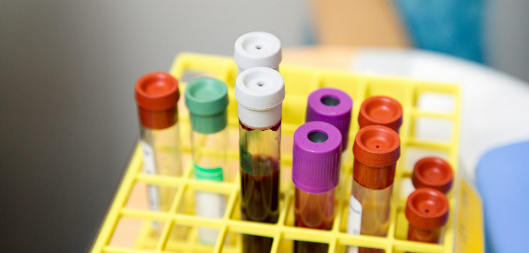 Photo, blood test vials
